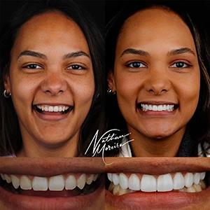 IMG - nm dental studio - resultado 01