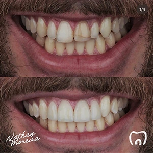 IMG - nm dental studio - resultado 0402